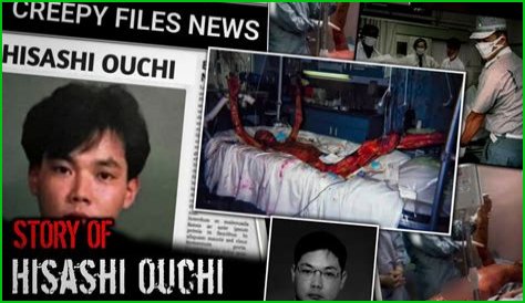 Hisashi Ouchi: The Story Of A Life Cut Short